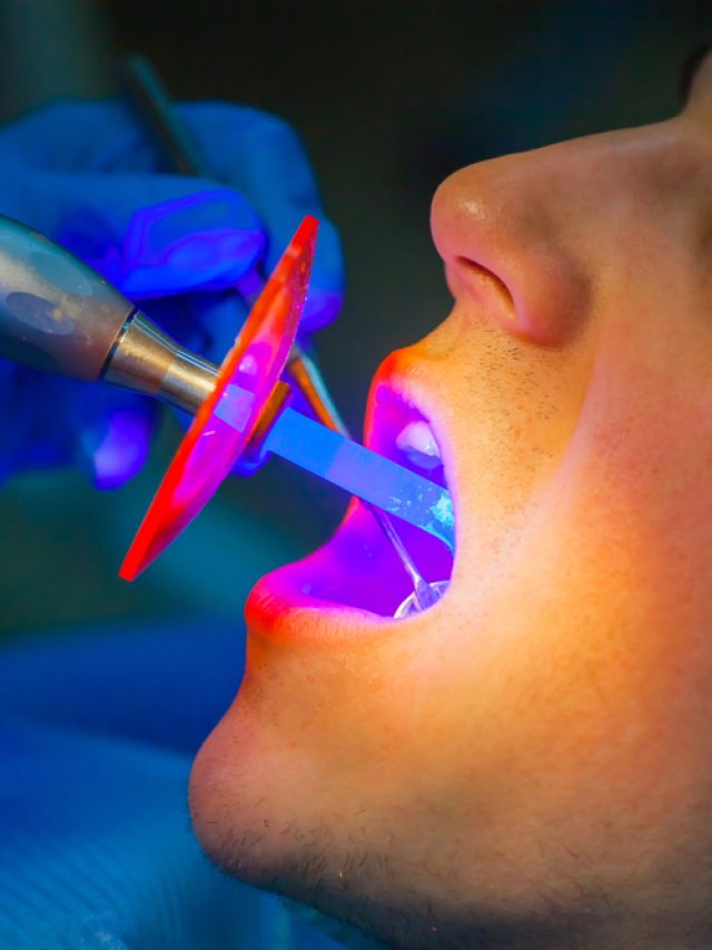 Did you know? Dentists can use lasers in many ways in dentistry, including;