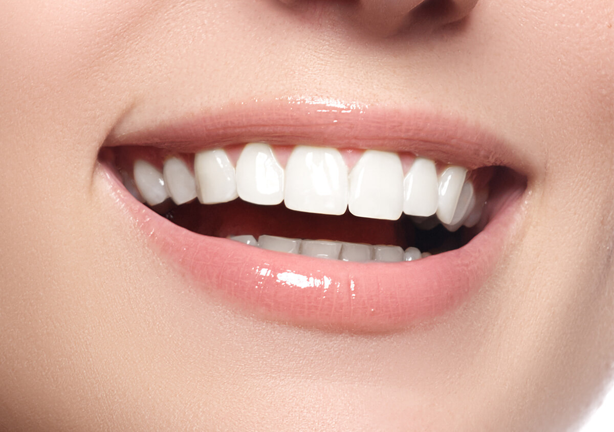 Professional Teeth Whitening in Bloomfield Hills MI Area